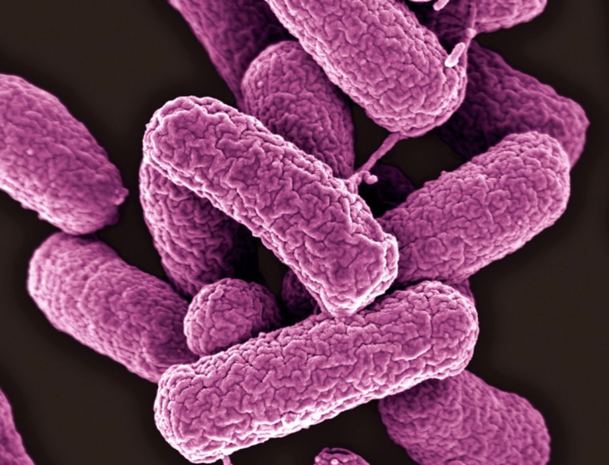El apocalipsis bacteriano podría estar más cerca