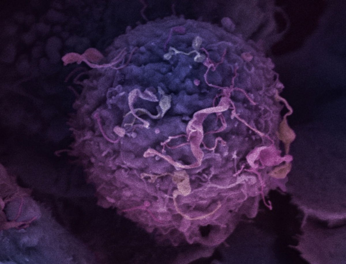 El cáncer tiene un nuevo enemigo