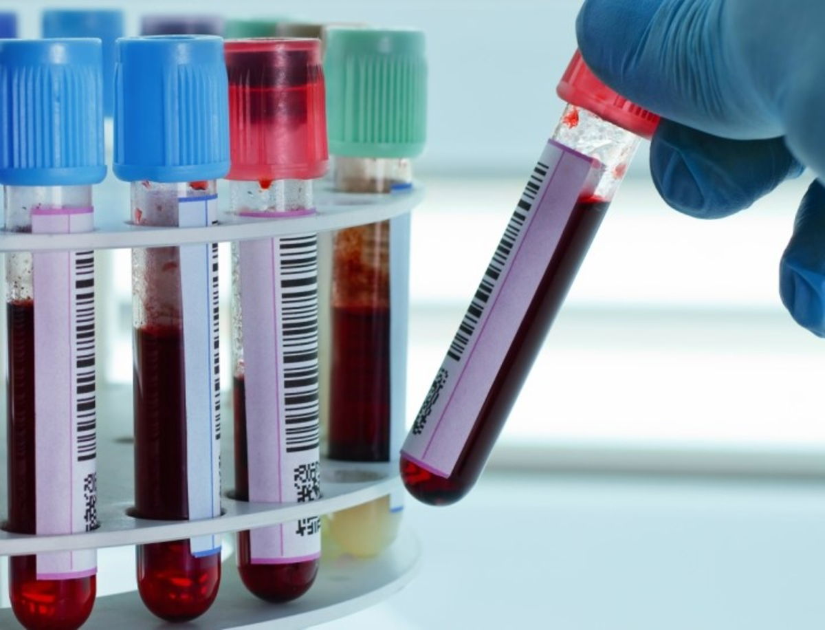 El análisis que puede detectar casi cualquier cáncer