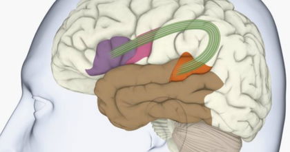 Cómo tu cerebro puede dejarte sin habla Cómo tu cerebro puede dejarte sin habla