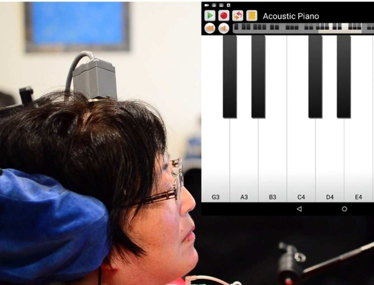Un implante cerebral consigue que las personas tetrapléjicas puedan usar un smartphone