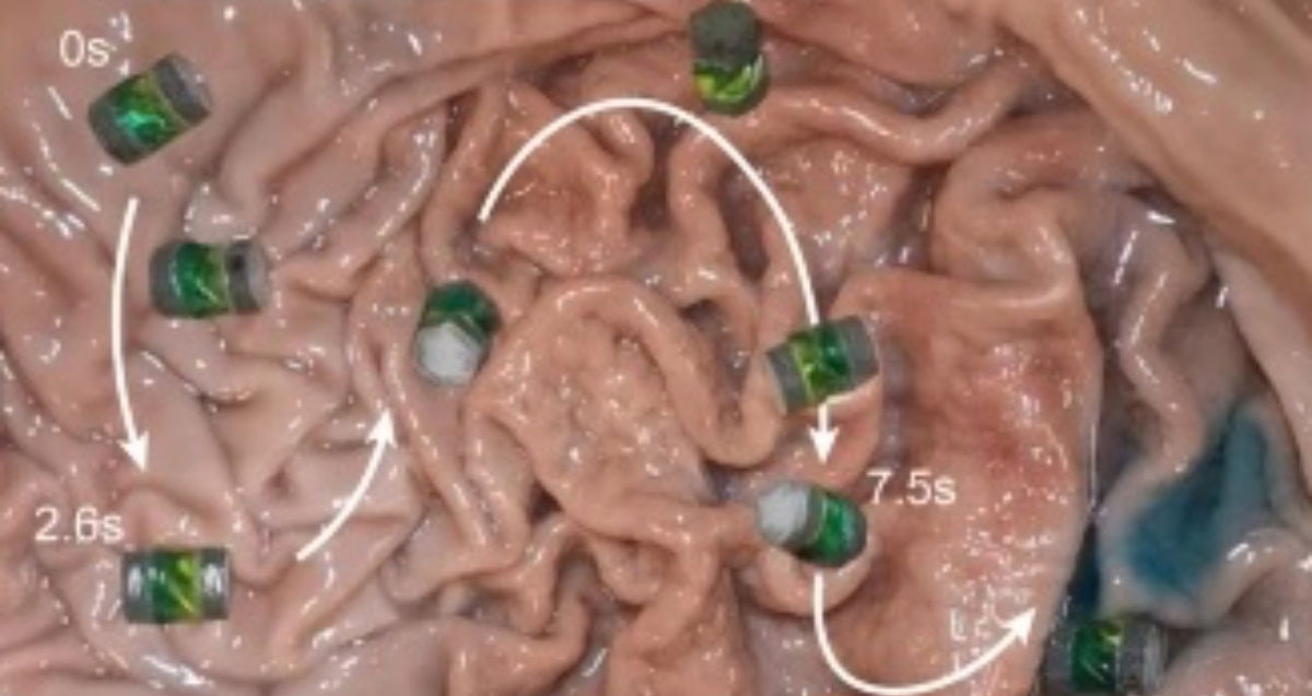Imagen del interior del estómago de un cerdo con uno de estos robots desplazándose