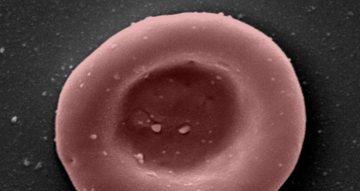 Imagen microscópica de un glóbulo rojo artificial