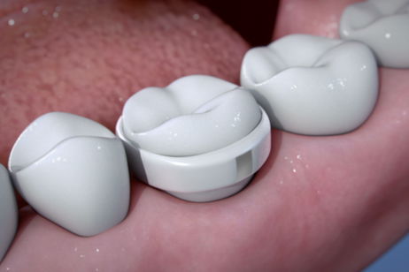 Una dentadura inteligente que analiza la saliva: lo último en tecnología wearable para medir tu salud