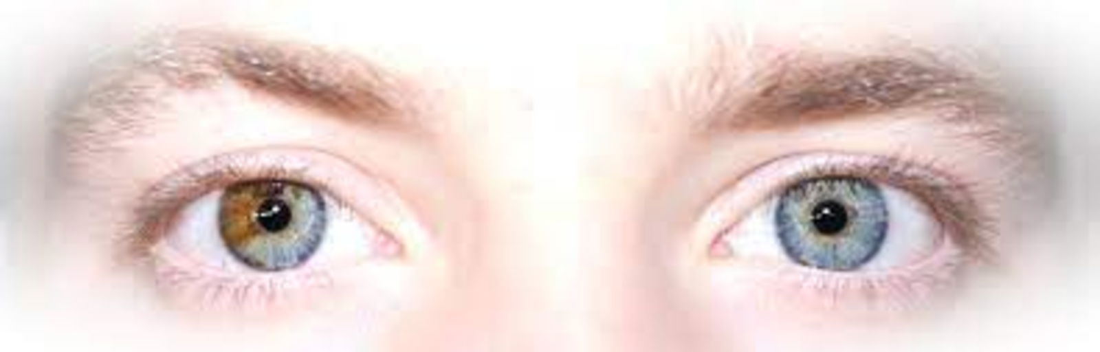 Heterocromía por qué hay gente con un ojo de cada color 2
