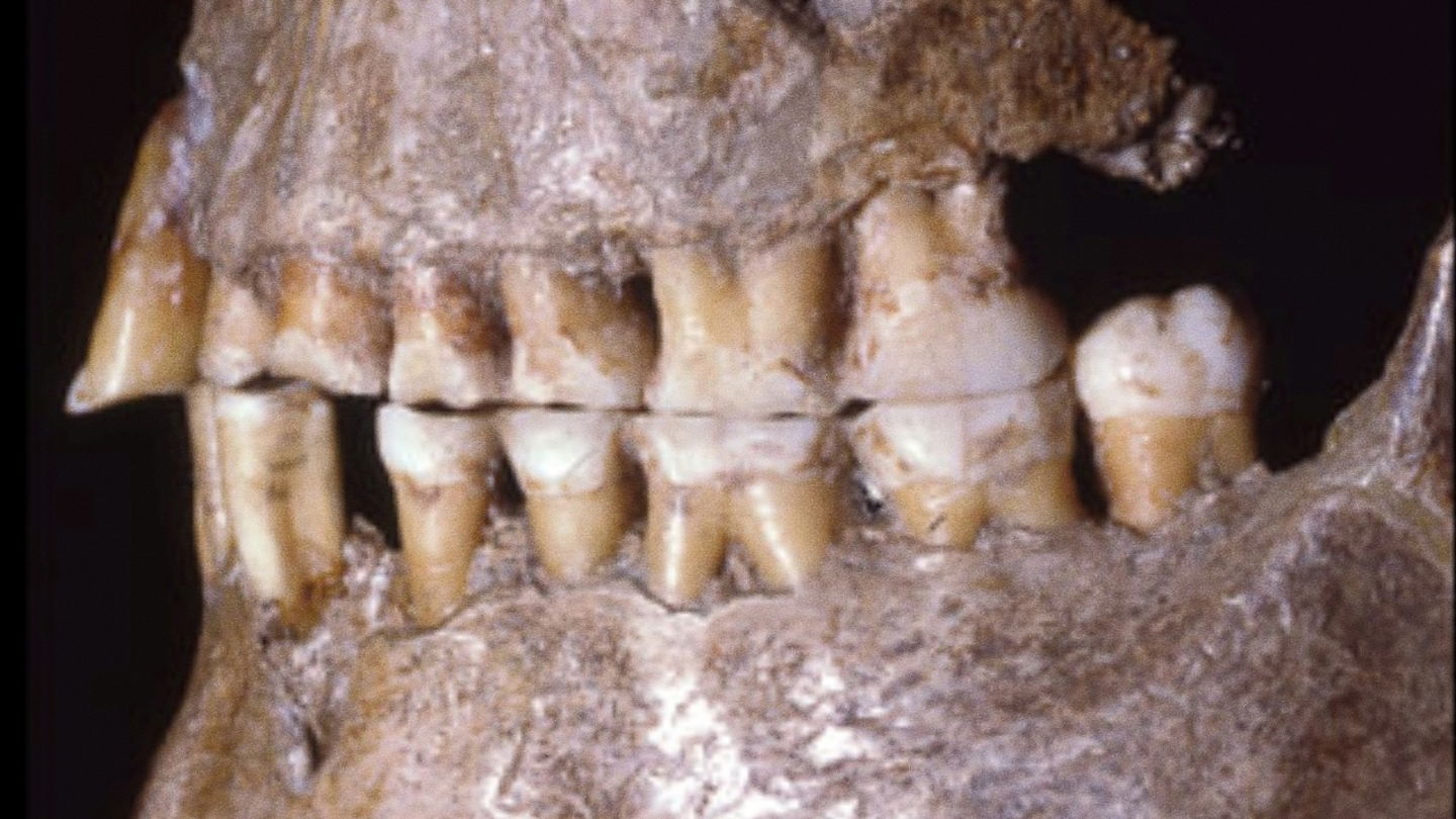 Demostración del desgaste de los dientes caninos y de la mejilla en una dentadura de un miembro del pueblo pavloviano