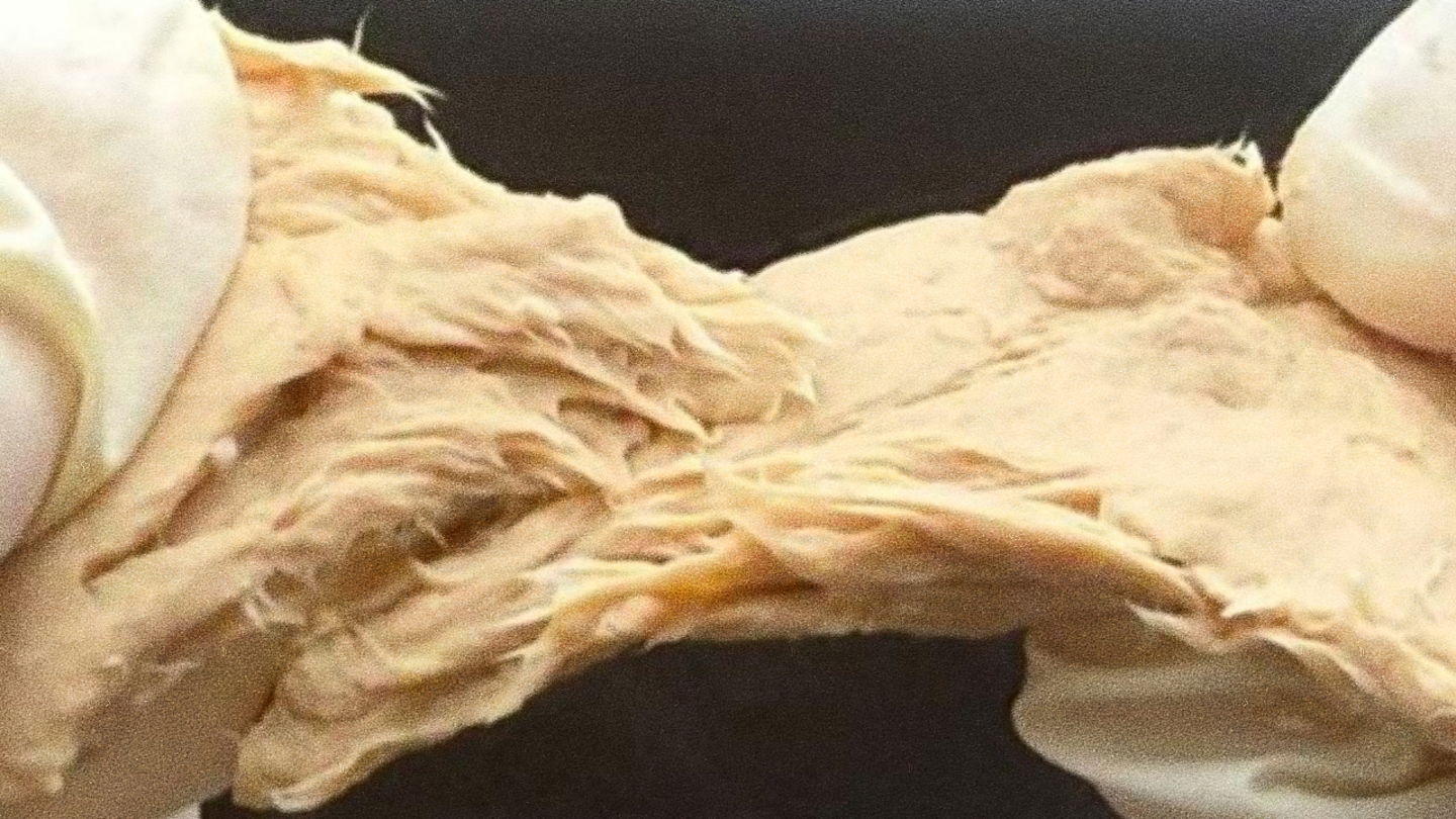 Así luce un Fusarium venenatum