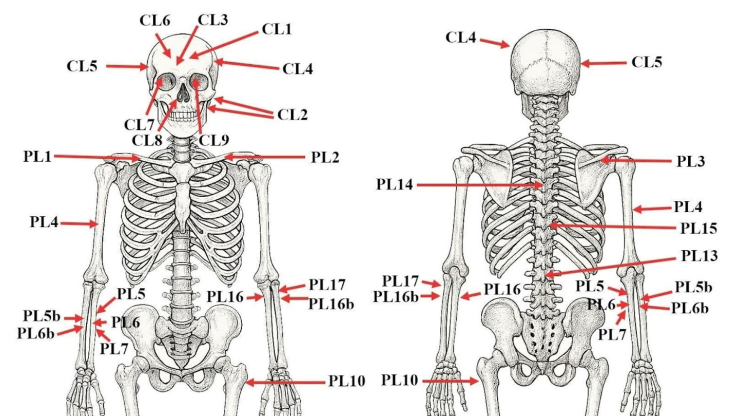 Lesiones observadas en los restos del misterioso ser humano analizado