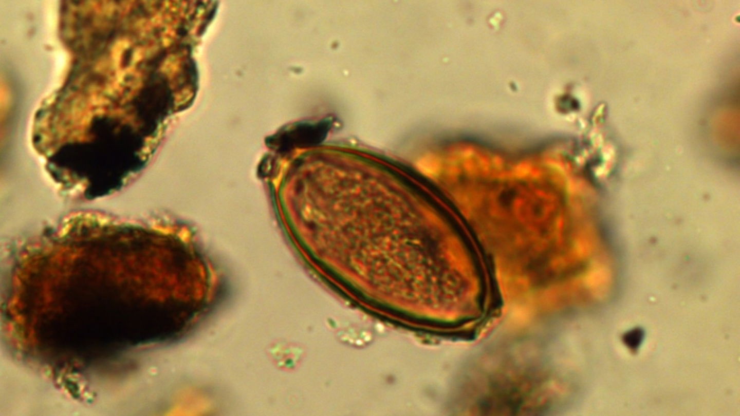 Huevo de tricocéfalo obtenido al analizar sedimentos del desagüe