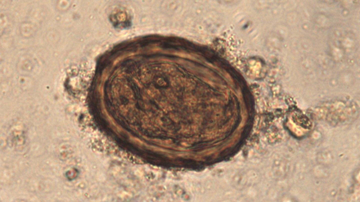 Un huevo de gusano redondo al microscopio