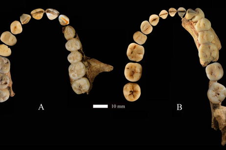 La primera visita al dentista de la historia ya tiene fecha: ocurrió hace 2.500 años y la hizo una mujer La primera visita al dentista de la historia ya tiene fecha: ocurrió hace 2.500 años y la hizo una mujer