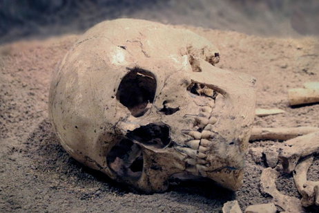 Analizan un esqueleto medieval y encuentran algo que no debería estar ahí Analizan un esqueleto medieval y encuentran algo que no debería estar ahí